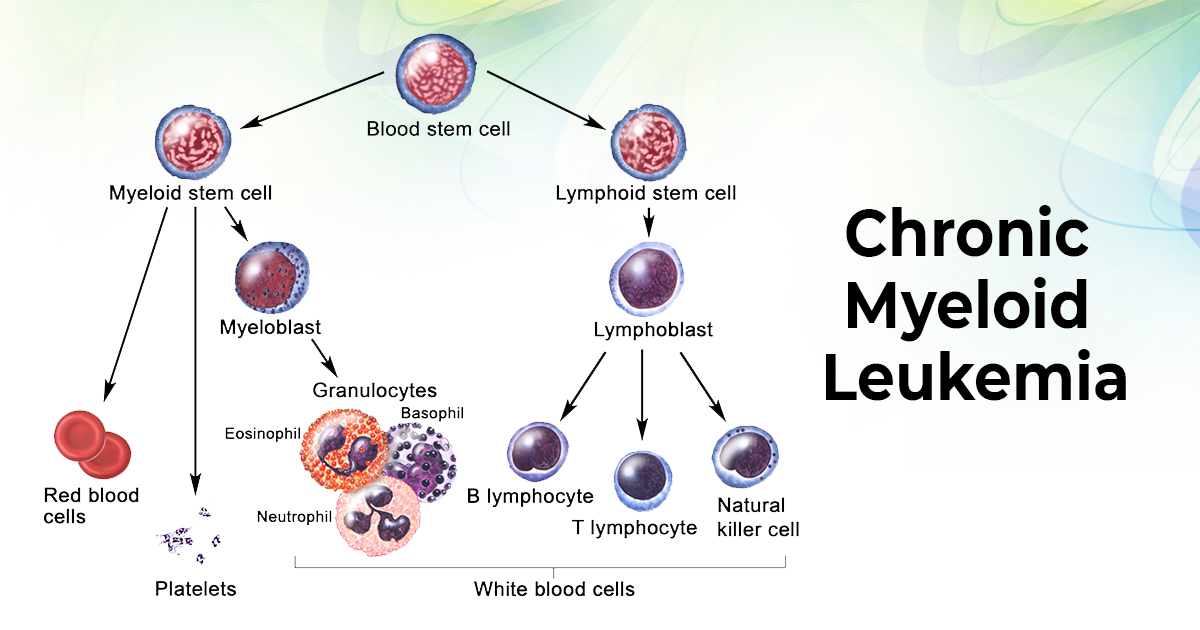 Chronic Myeloid Leukemia - Union Yoga Ayurveda