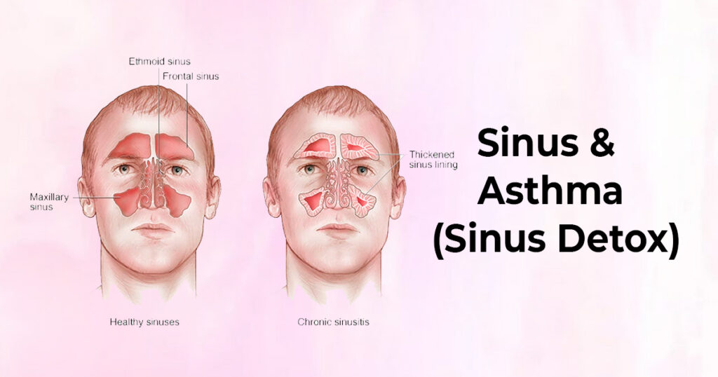 Sinus Detox - Union Yoga Ayurveda