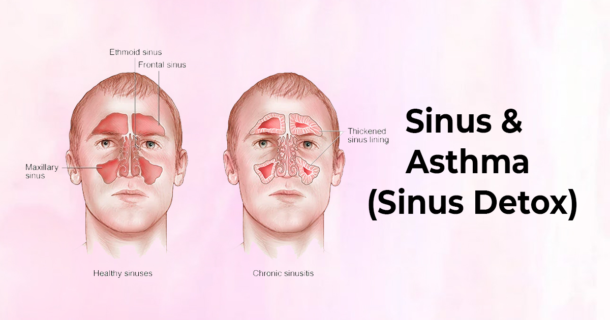 Sinus Detox - Union Yoga Ayurveda