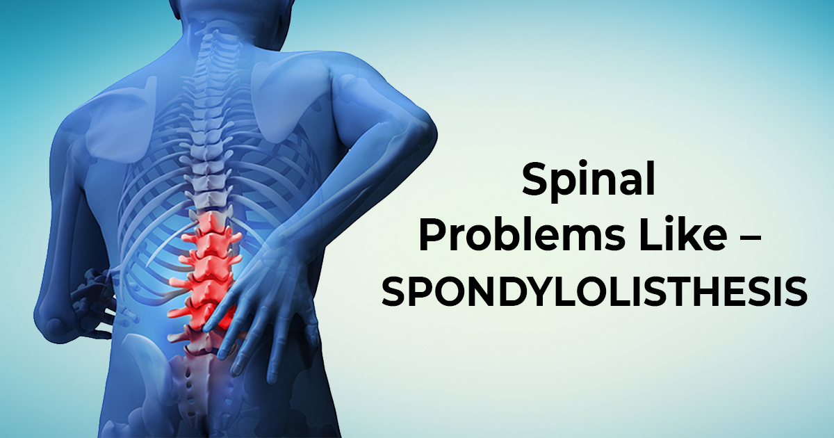 Spinal Problems Like-Spondylolisthesis - Union Yoga Ayurveda